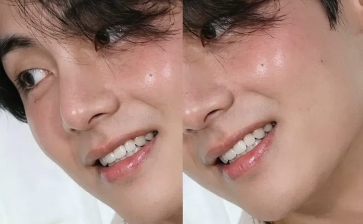 thvwonderland's tweet photo. just like his cheeks https://t.co/WTBsc0A24t