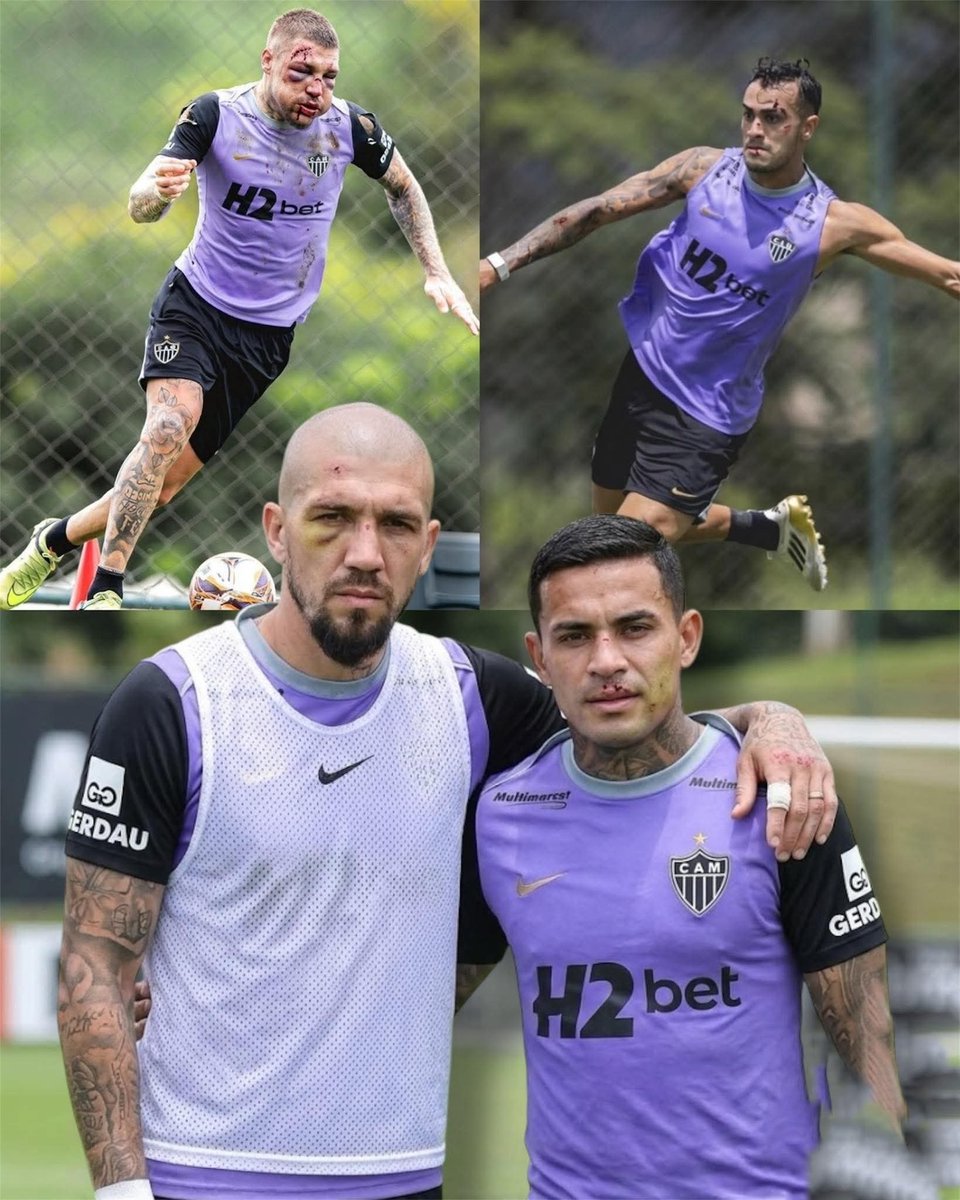 ¡¡INSÓLITO!! 🤯🇧🇷⚠️

Así fue 𝗟𝗟𝗘𝗚𝗔𝗥𝗢𝗡 el día de hoy algunos futbolistas del Atlético Mineiro a los 𝗘𝗡𝗧𝗥𝗘𝗡𝗔𝗠𝗜𝗘𝗡𝗧𝗢𝗦. Si, con cicatrices de la 𝗕𝗔𝗧𝗔𝗟𝗟𝗔 𝗖𝗔𝗠𝗣𝗔𝗟 que ocurrió en día de ayer contra el Cruceiro.

𝗗𝗘 𝗡𝗢 𝗖𝗥𝗘𝗘𝗥𝗦𝗘 😬🔥