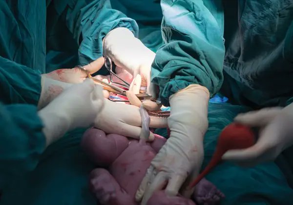 anesthesianews's tweet photo. Minimum standards. Maximum impact. 🌍
Global experts define the essential anesthesia requirements for safe cesarean delivery—helping hospitals everywhere meet the same floor of care. https://t.co/disrdhPIvF #csection #obsterics https://t.co/FarFWTqZPP