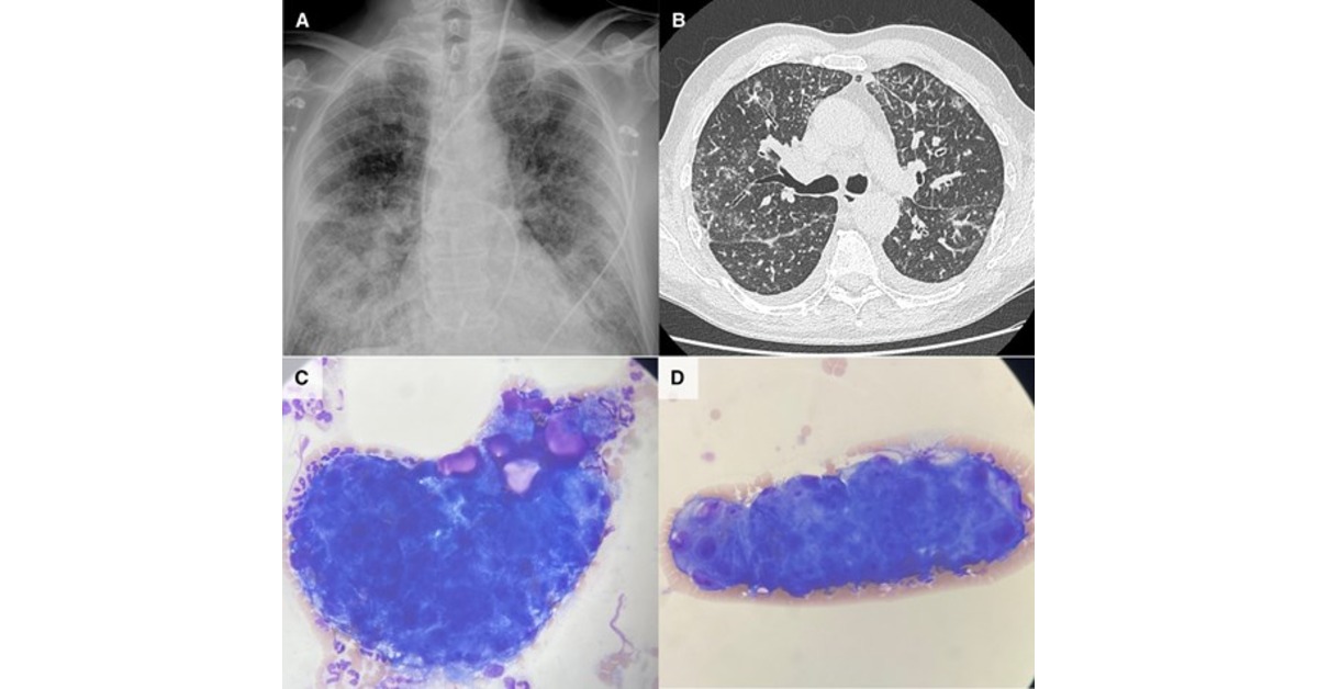 ATS Blue Journal tweet media