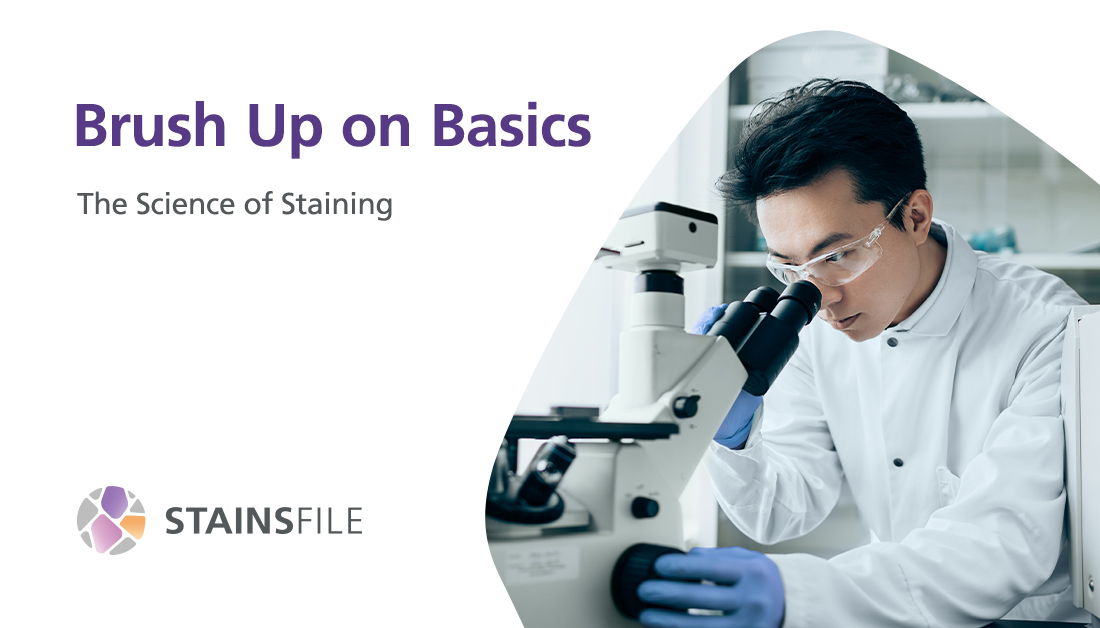 StainsFile tweet media