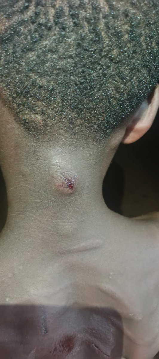 _GhChronicles's tweet photo. 🚨 JUST IN: A mother has allegedly flogged her 12-year-old daughter after the girl sold freshly harvested plantain without her permission, according to reports. https://t.co/fbJfnc2LBG