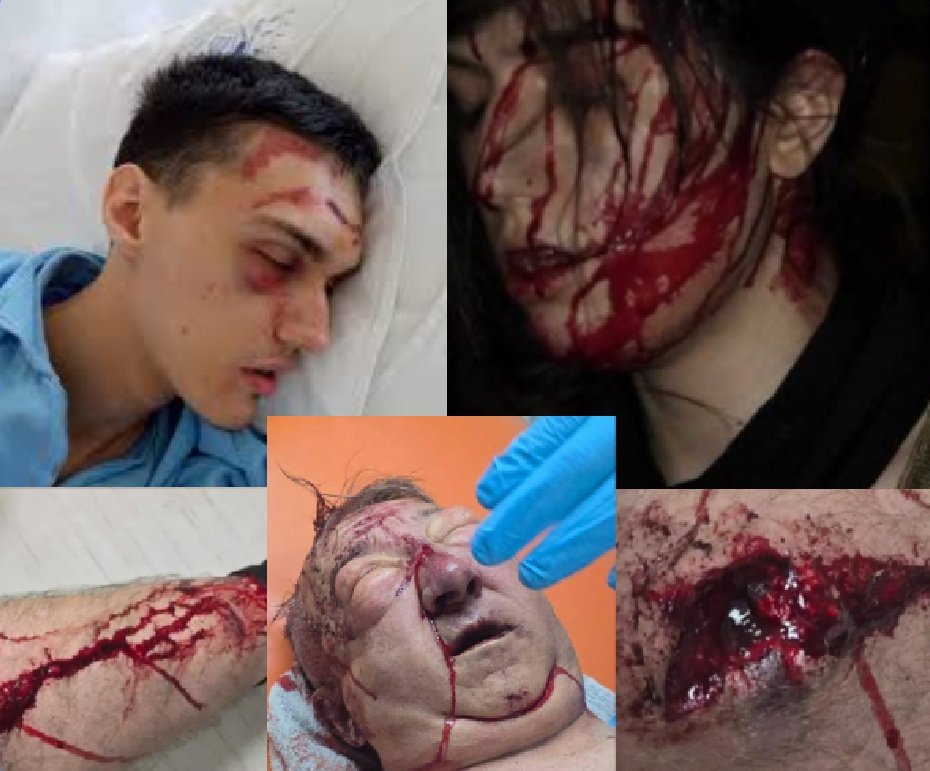 PIO Fond u blokadi tweet media