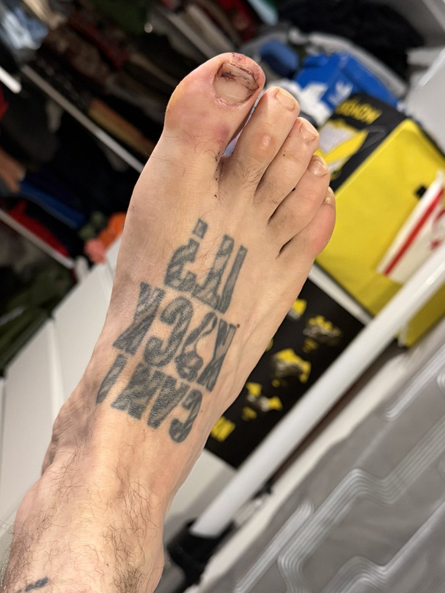 I fucked my foot yesterday playing hero stopping an XL Bully trying to attack people. I got a light chomp on the ankle, but a swift metal gate straight to its fucking nut ended the boss fight 💪🏼😆

Now I need you faggets to $niff &amp; $end 😤