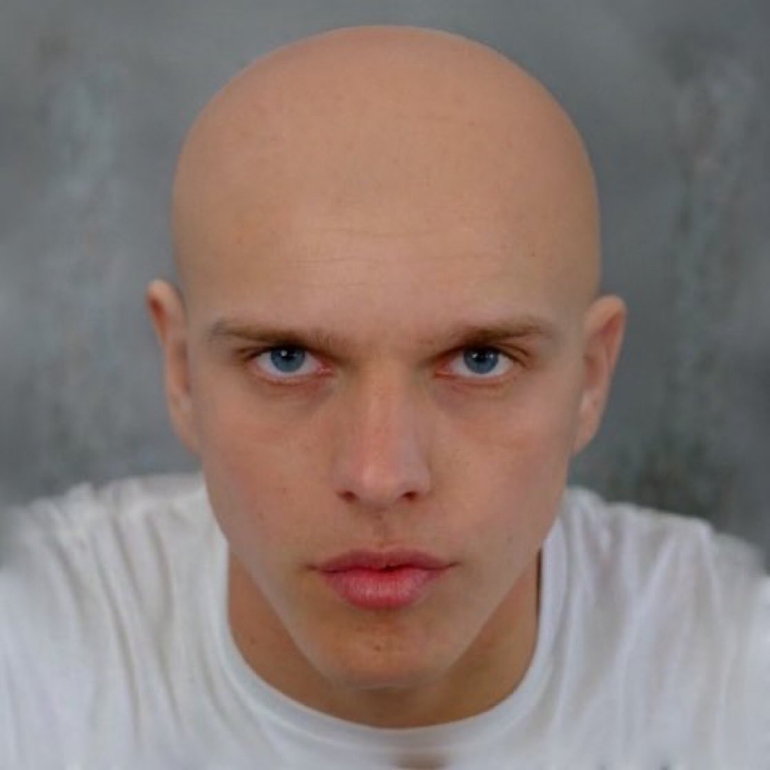 “I’ve cut it off brother.. I didn’t want to look like you”