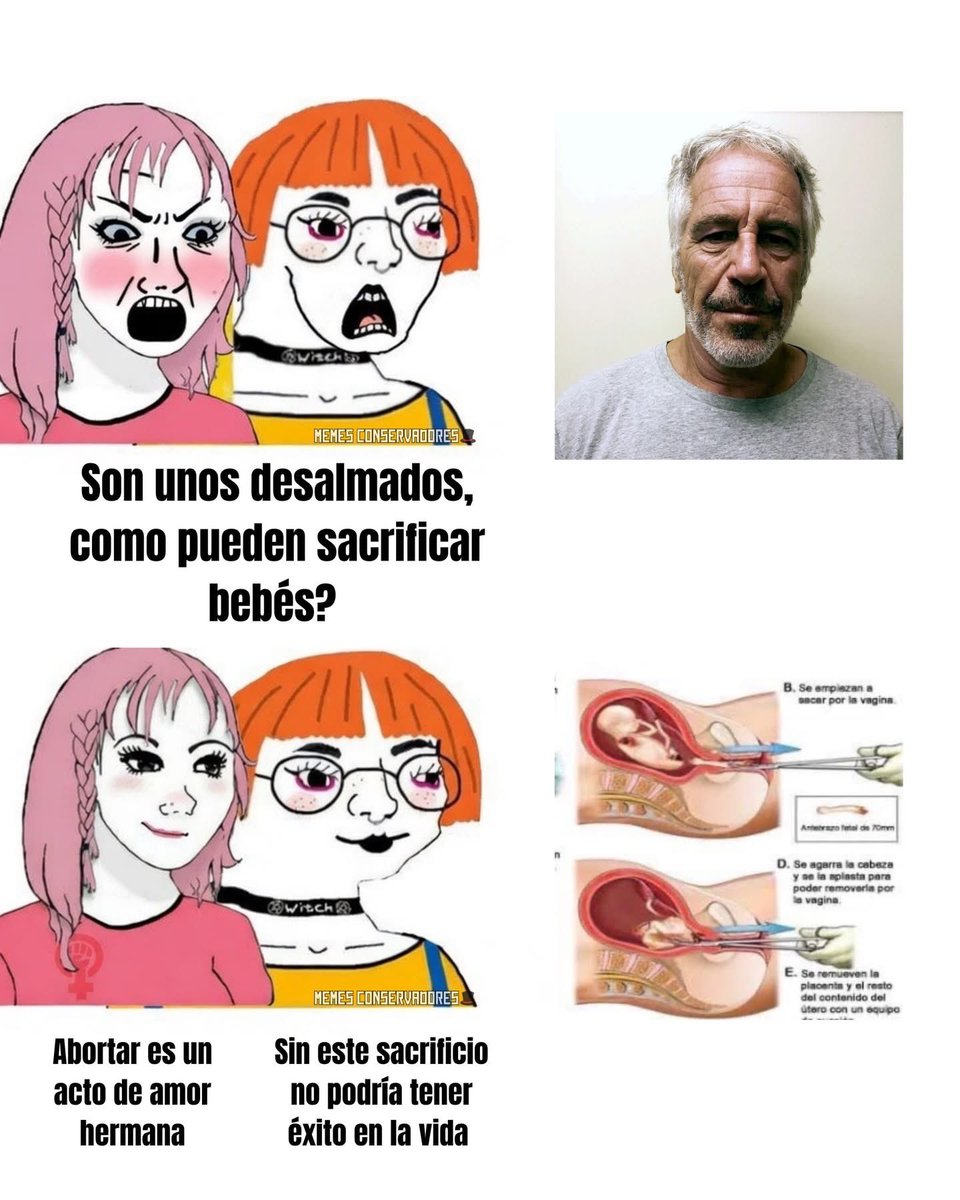 Authentic Tlacuache 🤘🦡🏳️‍🌈 tweet media