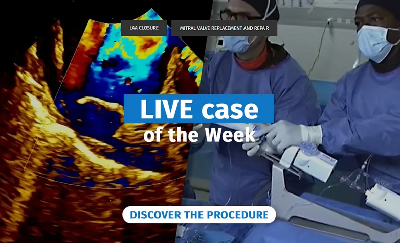 PCRonline 🫀 tweet media