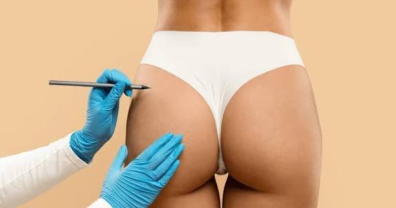 Let's be honest.
The BBL era convinced an entire generation of young women that surgery was self-care.
Now the women who led that trend are reversing it.
And the girls who followed them are left with receipts they can't return. 💔🍑