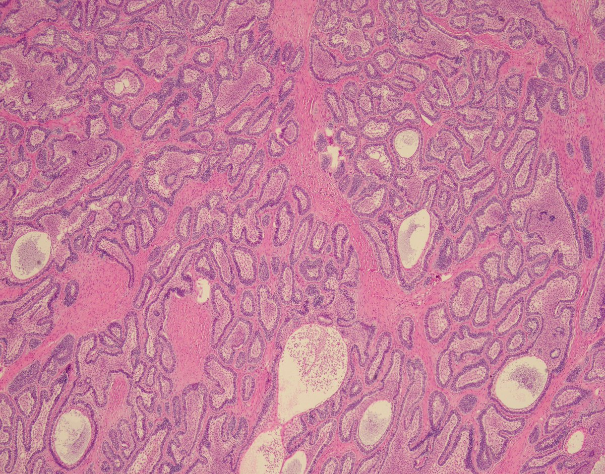 UAB Pathology tweet media