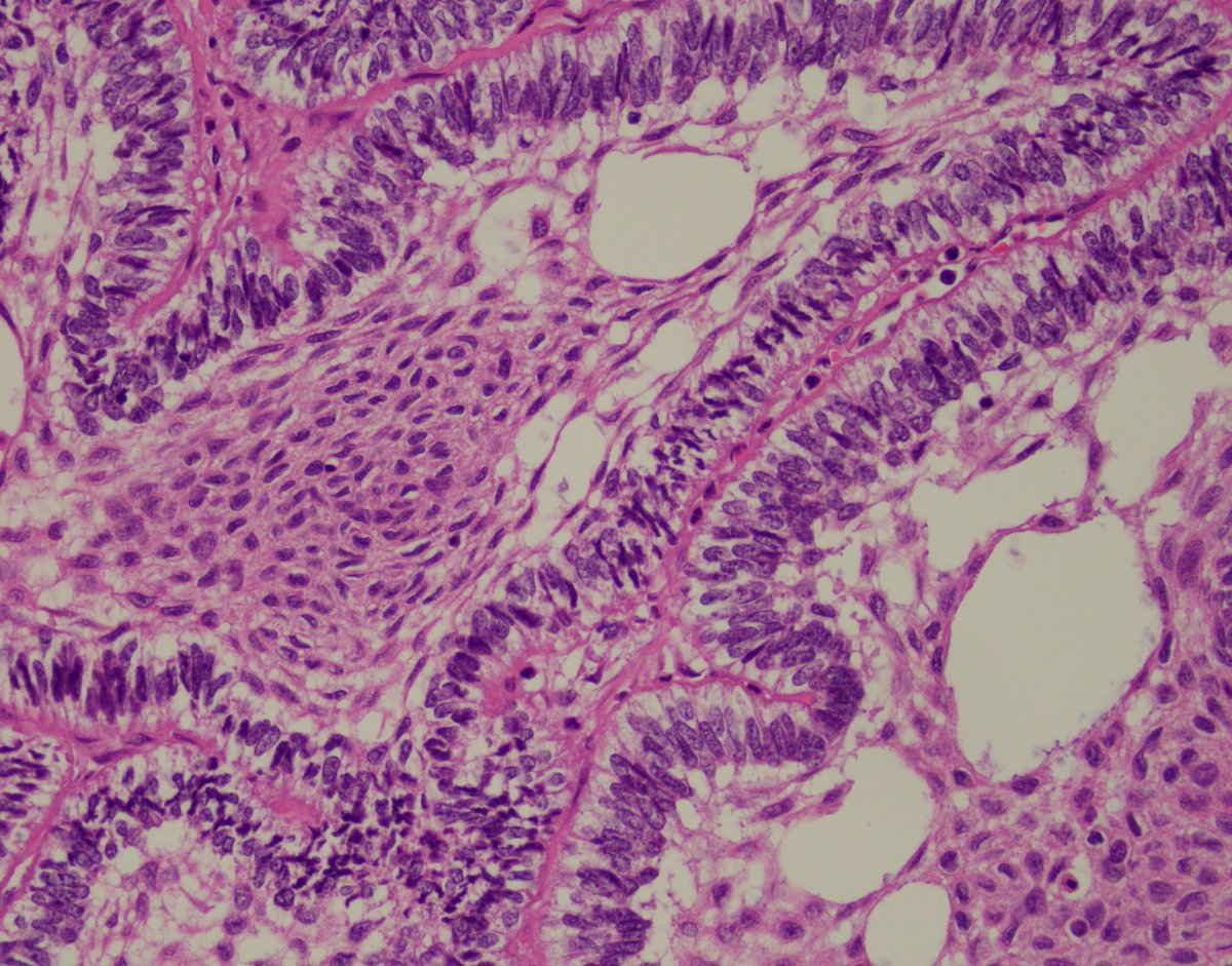 UAB Pathology tweet media