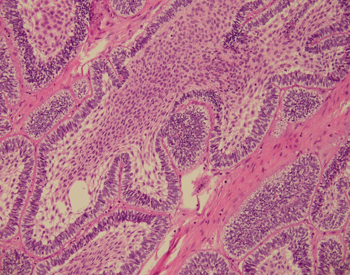 UAB Pathology tweet media