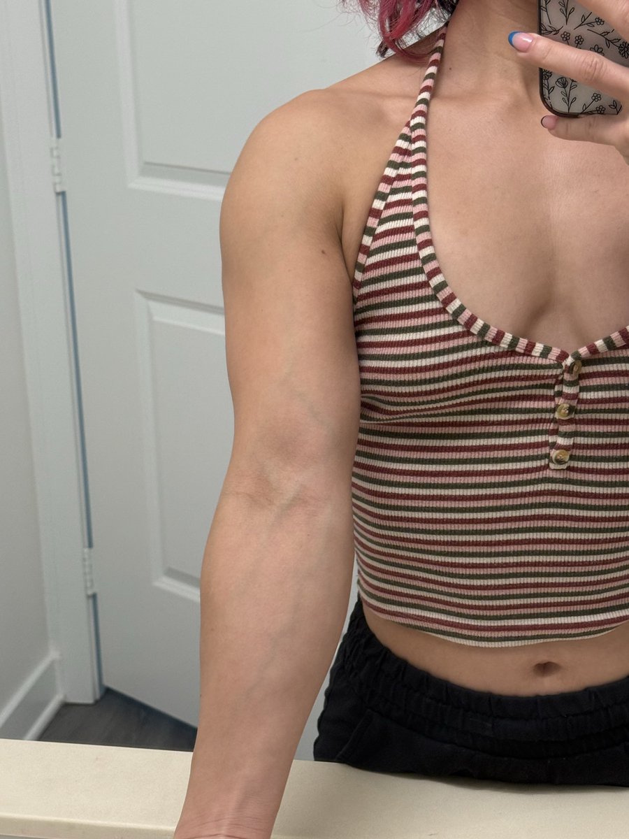 insanely thick veins