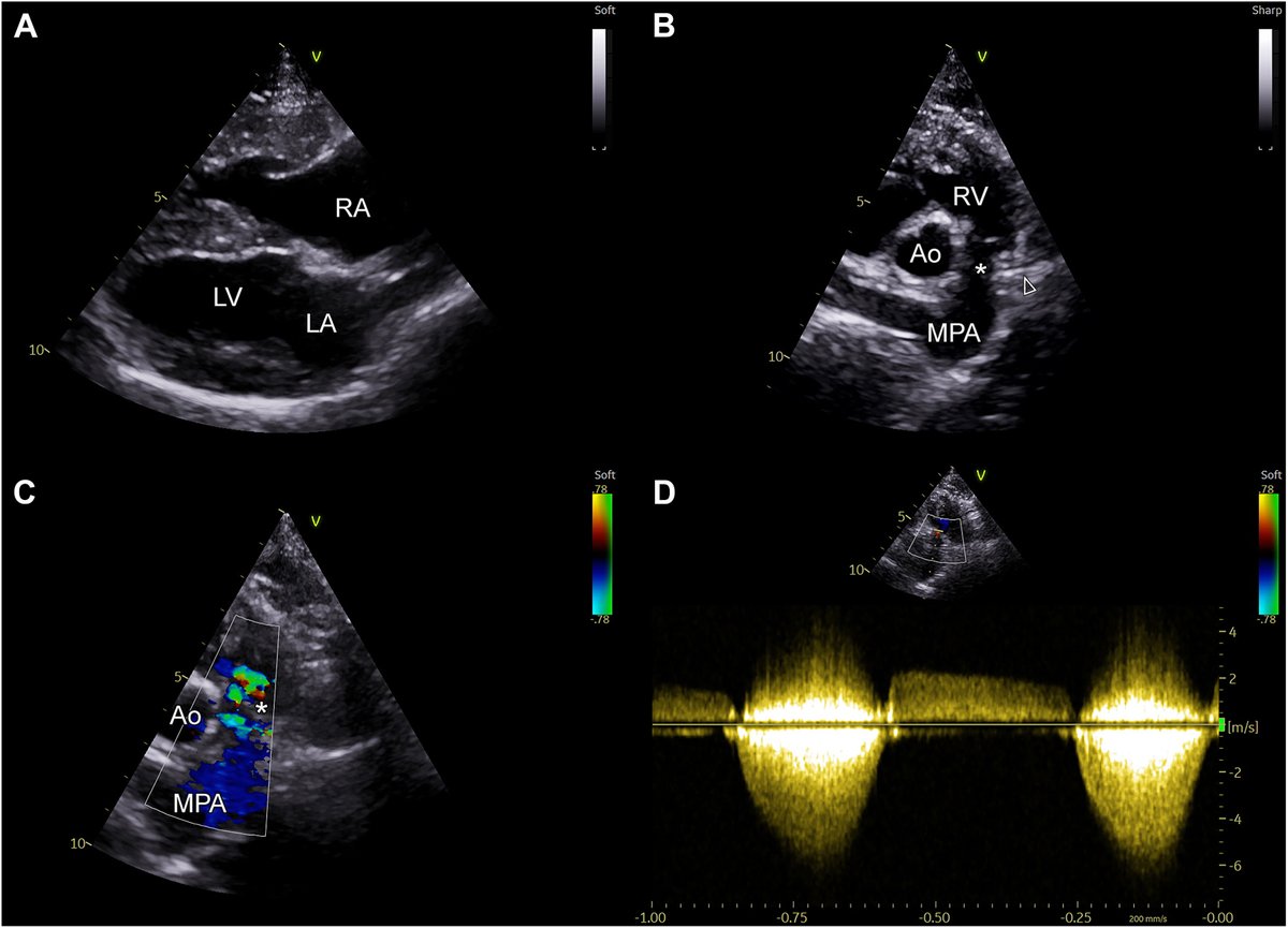 American Society of Echocardiography tweet media
