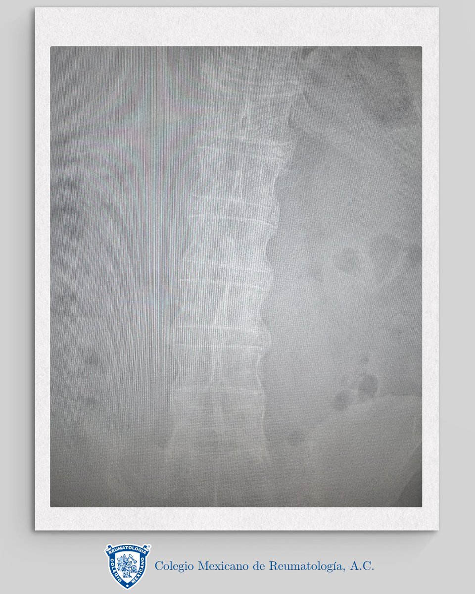 ColMexReuma tweet media