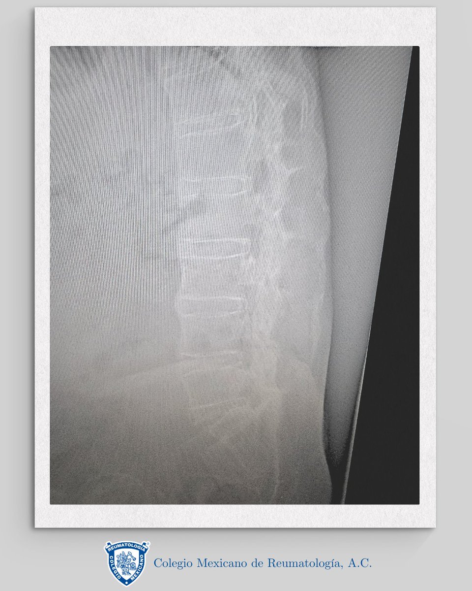 ColMexReuma tweet media