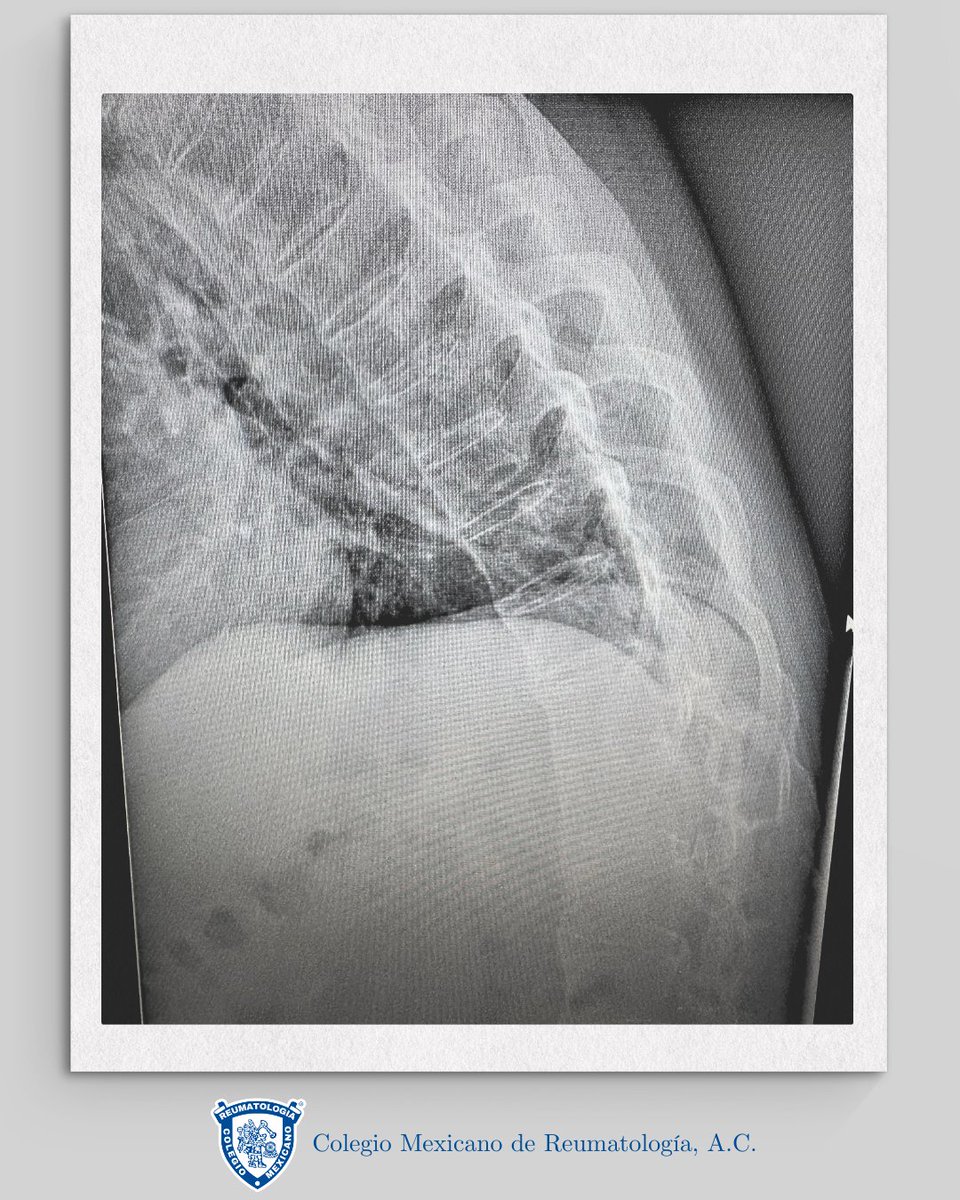 ColMexReuma tweet media