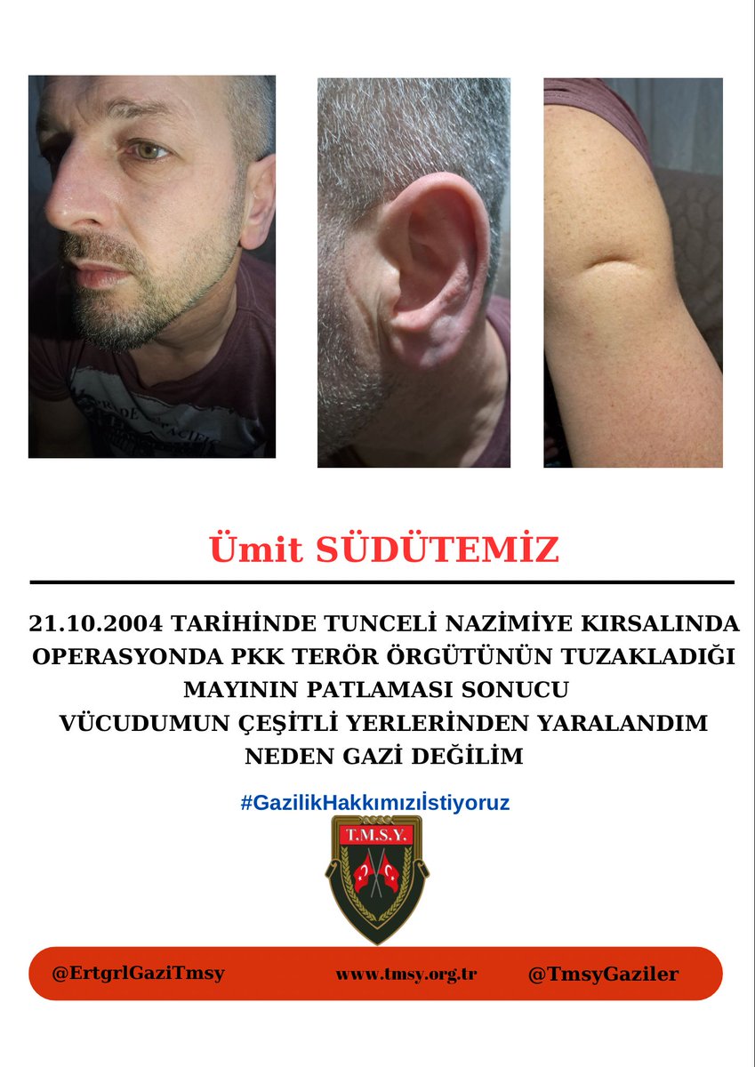 <a href="/MHP_Bilgi/">MHP</a> <a href="/MhpTbmmGrubu/">MHP TBMM Grubu #MHP</a> Şehitlik ve gazilik bu toprakların en kutlu mertebesidir. Bizler bu mertebenin bedelini çatışma bölgelerinde ödedik. 
#GazilikHakkımızıİstiyoruz
<a href="/RTErdogan/">Recep Tayyip Erdoğan</a> 
<a href="/dbdevletbahceli/">Devlet Bahçeli</a> 
<a href="/hulusiakarmedya/">Hulusi AKAR</a> 
<a href="/MahinurOzdemir/">Mahinur Özdemir Göktaş</a>
<a href="/celebimehmeta/">Mehmet Ali Çelebi</a> 
<a href="/refik_ozen16/">refik ozen</a> 
<a href="/ifarukaksu/">İsmail Faruk Aksu</a> 
<a href="/kocakkonuralp/">Konur Alp Koçak</a> uu