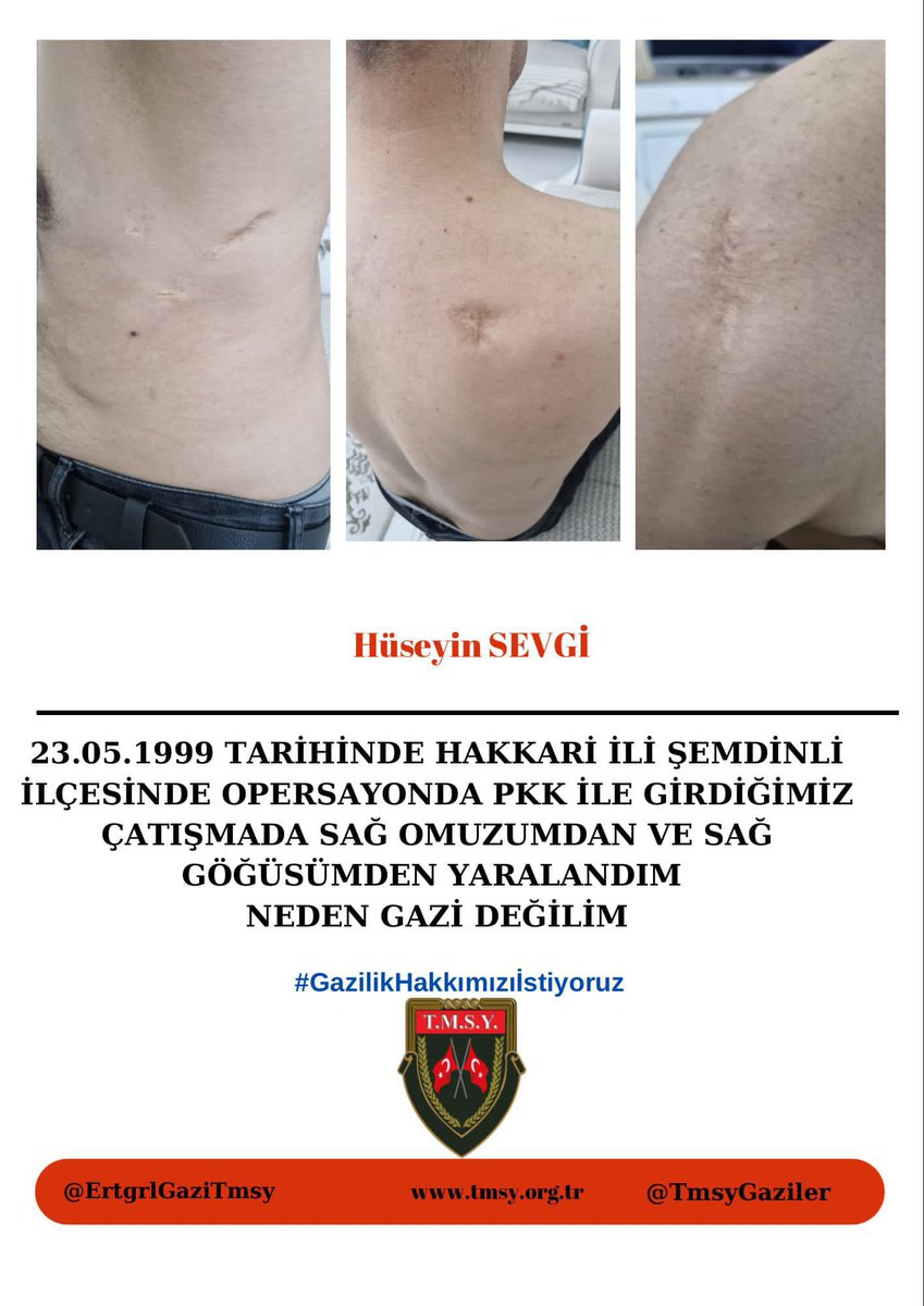 <a href="/MHP_Bilgi/">MHP</a> <a href="/MhpTbmmGrubu/">MHP TBMM Grubu #MHP</a> Yıllardır aynı duayla bekliyoruz: Adalet, vefa ve gazilik onurumuzun teslimi. Sn Bahçeli’den bu konuda güçlü bir adım bekliyoruz.
#GazilikHakkımızıİstiyoruz
<a href="/dbdevletbahceli/">Devlet Bahçeli</a>
<a href="/hulusiakarmedya/">Hulusi AKAR</a> 
<a href="/MahinurOzdemir/">Mahinur Özdemir Göktaş</a> 
<a href="/celebimehmeta/">Mehmet Ali Çelebi</a>
 <a href="/refik_ozen16/">refik ozen</a> 
<a href="/ifarukaksu/">İsmail Faruk Aksu</a> 
<a href="/kocakkonuralp/">Konur Alp Koçak</a> hh