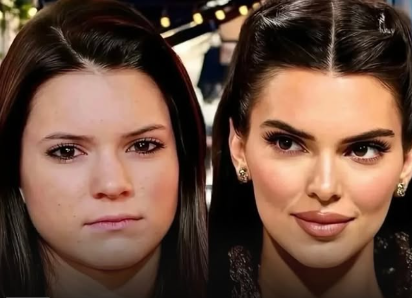 tedcinema's tweet photo. I've never had any plastic surgery. The only thing I've done twice is Botox in my forehead. - Kendall Jenner

Do you Believe ? https://t.co/cq2PJPocnv