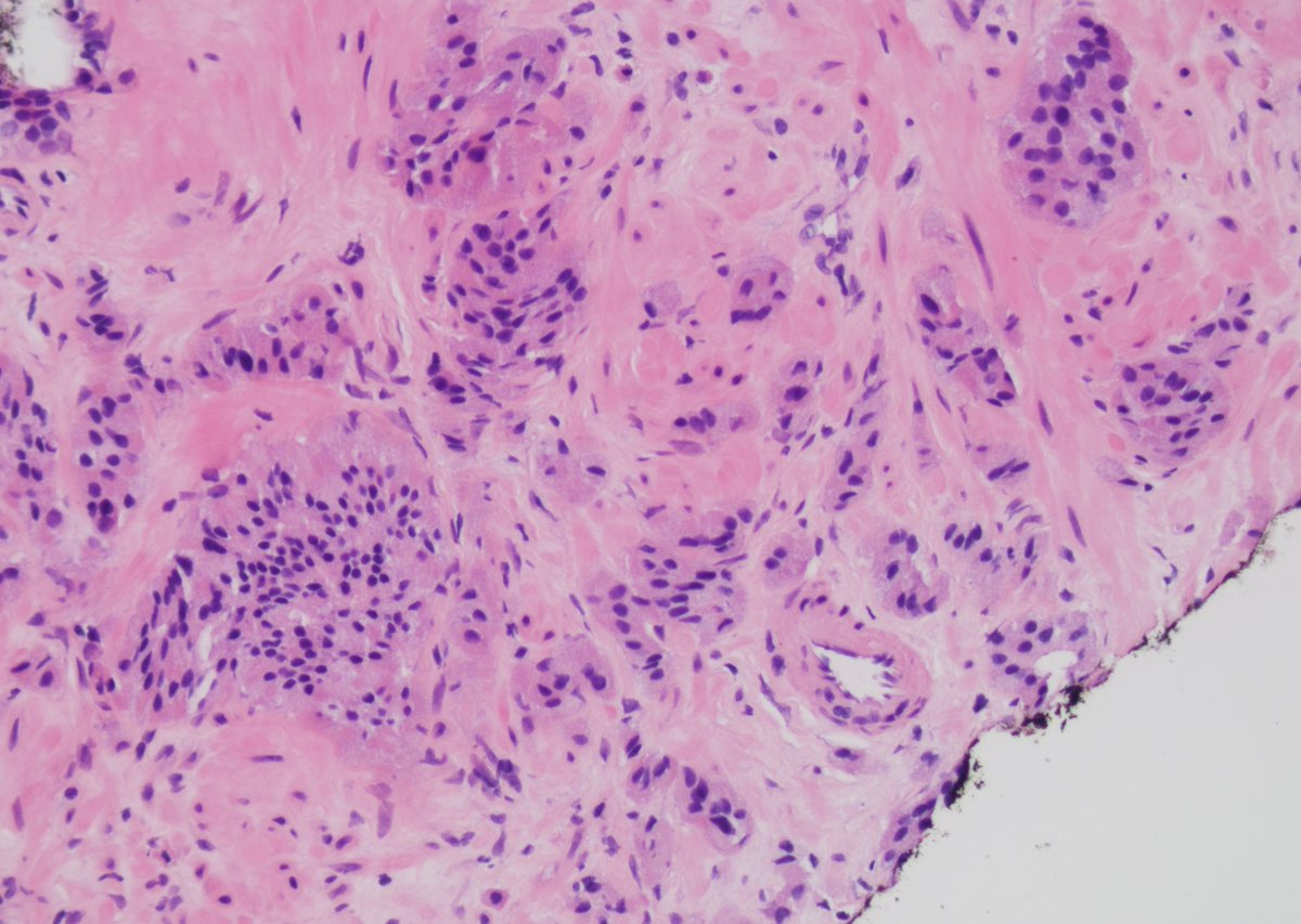 Andres Matoso tweet media