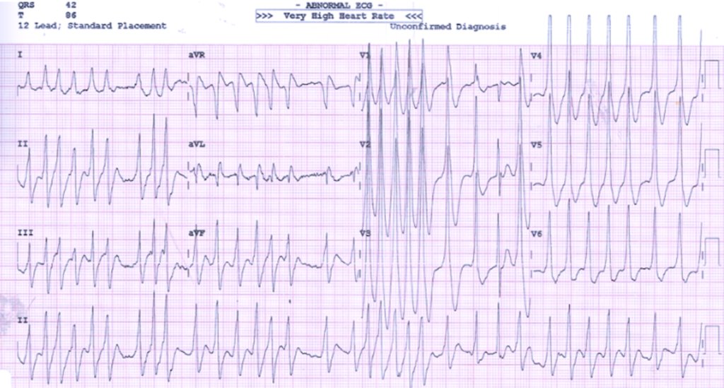 ECGWeekly tweet media