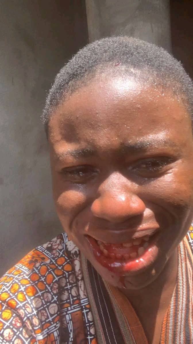Miss Ogadinma Minnie Uchechi was alleged to have been assaulted by the Chairman of Ahoada West Local Government Area, Eugene Cheta Epelle..

According to Miss Ogadinma, her offence was making a Facebook post highlighting the deteriorating and unsafe learning environment at
