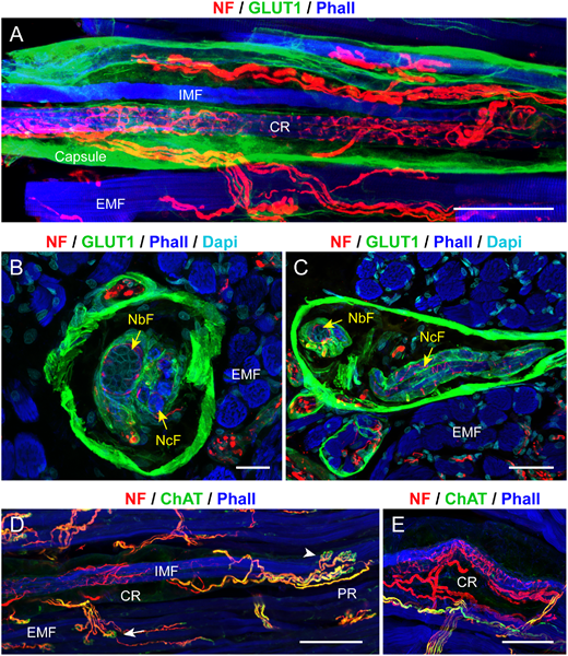 ARVOiovs's tweet photo. Génova Carrero-Rojas et al. from Universidad de Sevilla find that classical proprioceptors and palisade endings have distinct molecular profiles in pig eye muscles. 
https://t.co/cnIvUwoZwr https://t.co/vyL71BoBl4
