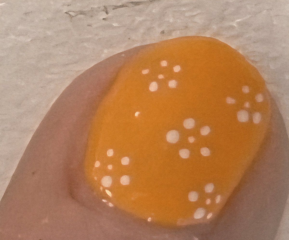 lynjobaggins's tweet image. A #ManicureMonday
brightening up a dreary grey day,
with a nod to Spring on the 3rd nail on both hands🌼💅