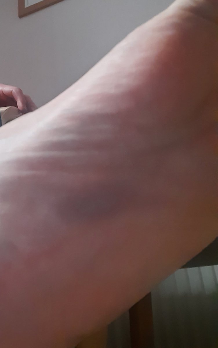 kamikaze kevin ⛓️🛬😈🥳 tweet media