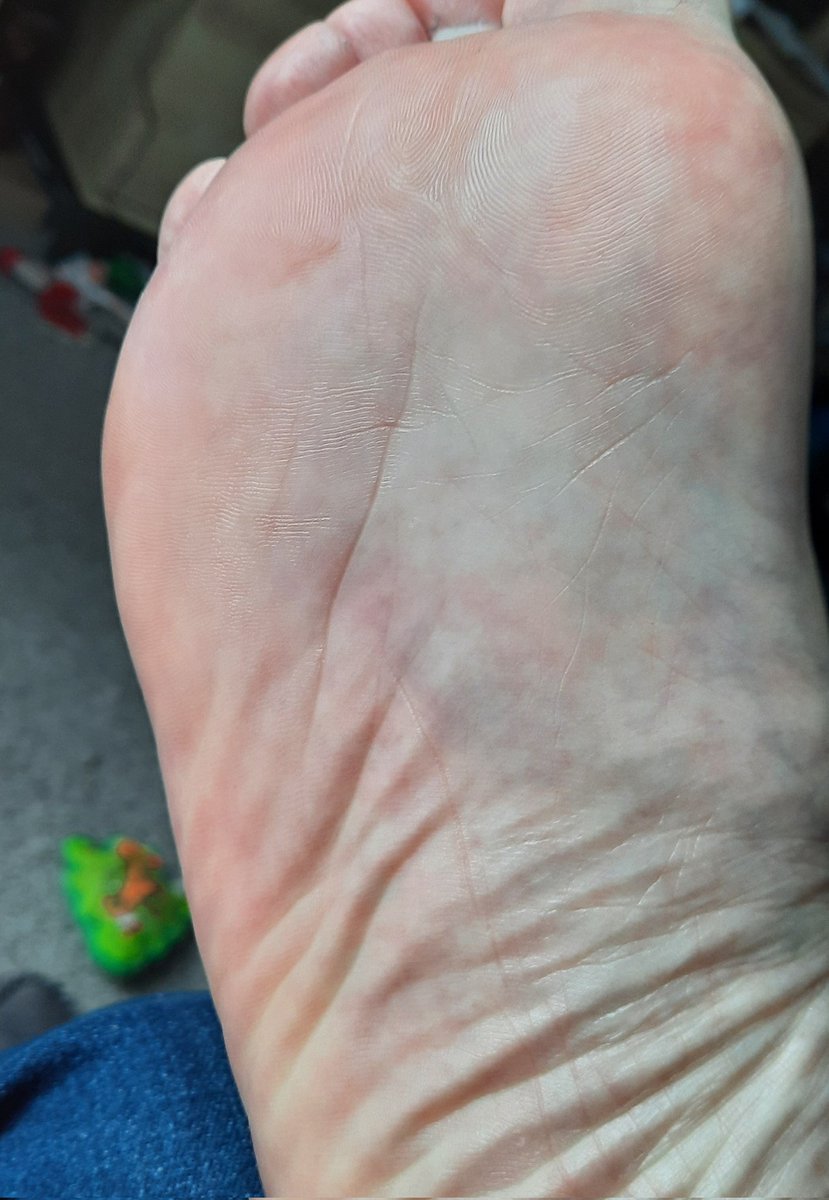 kamikaze kevin ⛓️🛬😈🥳 tweet media