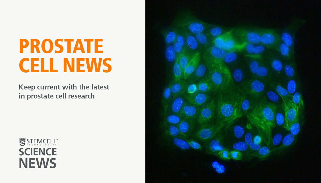 Prostate Cell News tweet media