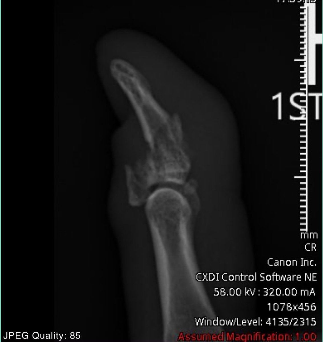 voddysodas's tweet image. “Now shatter his thumb” #Heatcheck