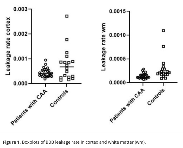 IntJStroke's tweet photo. 🧠(DCE)-MRI study in cerebral amyloid angiopathy (CAA)

🧑‍🤝‍🧑25 probable CAA + 19 matched controls

In CAA: 
⬇️Global parenchymal gadolinium extravasation across the BBB was lower
⬆️Higher presence of focal leptomeningeal enhancement

Read more here!👇
https://t.co/hB0sYgicgY https://t.co/WKFqqbTegQ