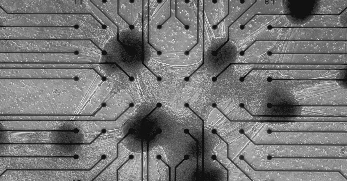 Tu cerebro gasta 20 watts — menos que una lamparita — y es más eficiente que cualquier supercomputadora jamás construida. Eso hizo que científicos se preguntaran: ¿y si en vez de simular cerebros con silicio, usamos neuronas reales?