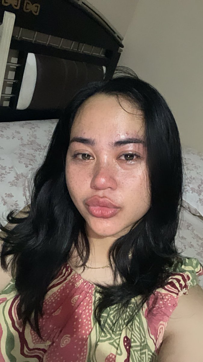 anakgadis ✨ tweet media