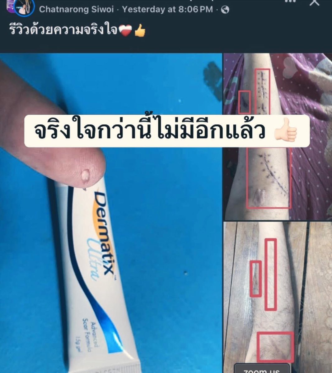 สำหรับเธอ… tweet media
