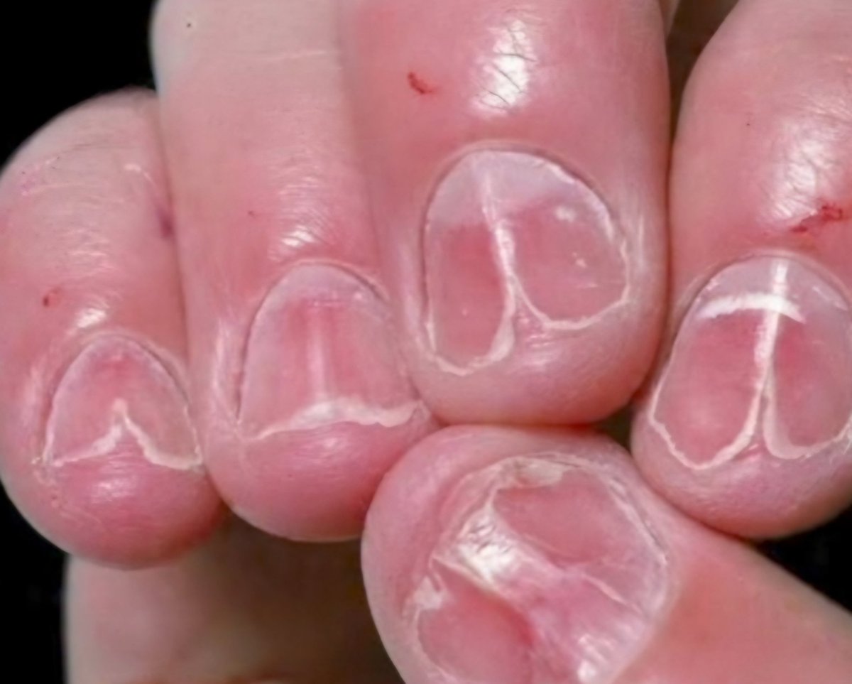 nervemed tweet media