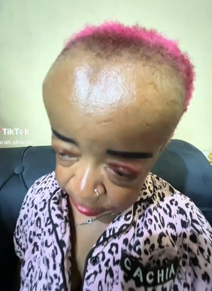 TinaInnocent5's tweet photo. @instablog9ja Hair downdruff https://t.co/yCEAnataEp