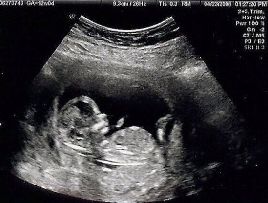 una foto de cuando no tenía problemas de autoestima ni ansiedad