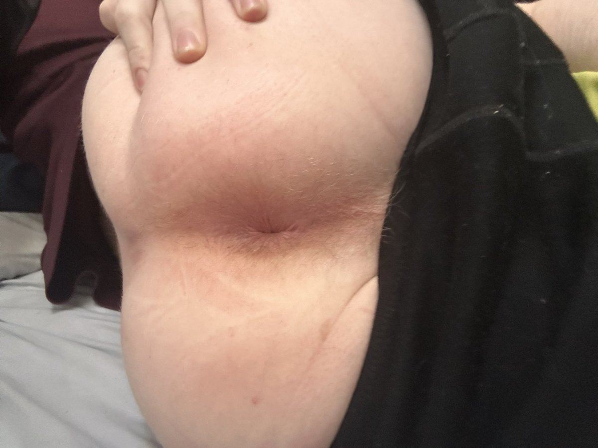 twinkforuse247's tweet photo. Hey all sorry I been away for a while, haven’t taken any content recently, and had to leave Plymouth unfortunately, posting a old couple of photos, hopefully should be returning to normal posting within a month or so 🫶���🫶🏻😋🍑🔥🤭 #slut #of #gay #slut #plugged #anal #ass #tight https://t.co/AtlRnN3KVY