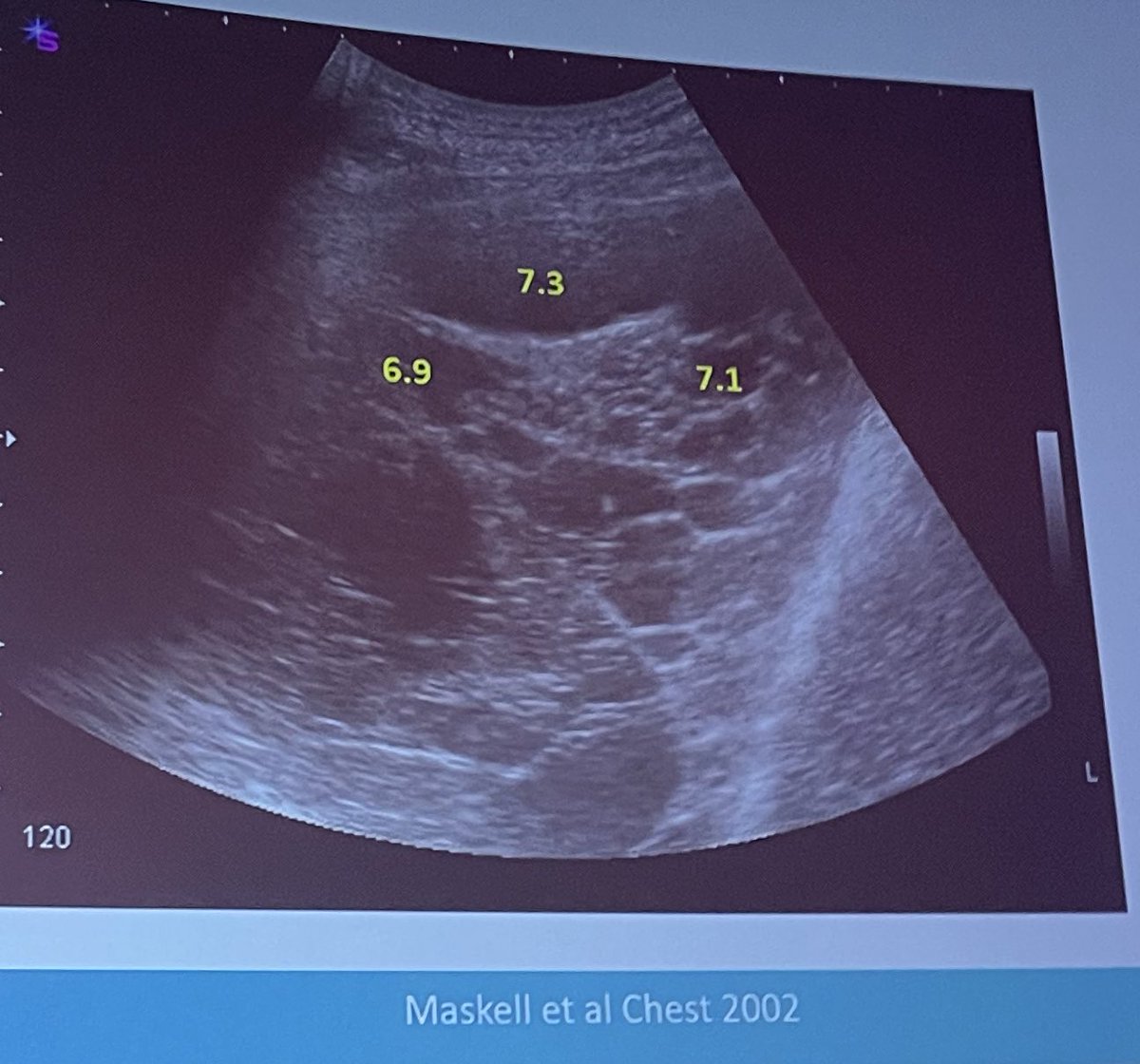 Emily Ward tweet media