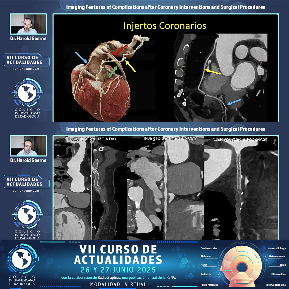 HaroldGoerne's tweet photo. #YesCCT #WhyCMR #cardiovascular #radiology #cardiology https://t.co/ku0oDRRgwg