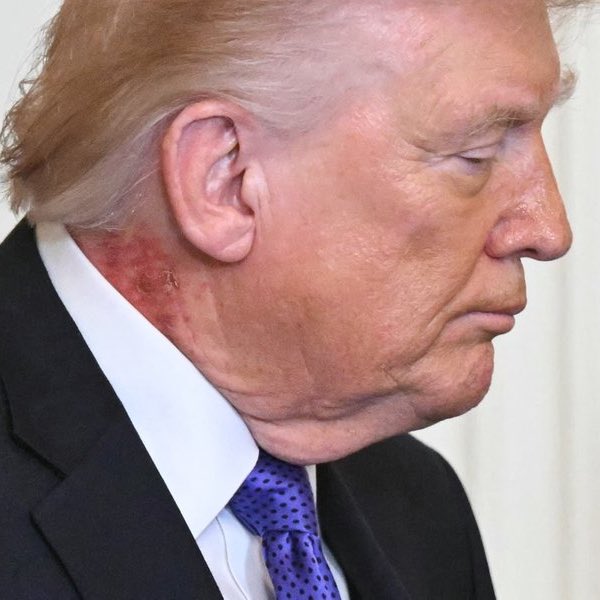 Enabdiaziz's tweet photo. #Trump a symbol of the bloodshed and massacre he inflicted on the people of Islam is visible on his body #Iran #Israel https://t.co/8XyAcNijHD
