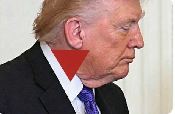 Retired dermatologist's daughter here.

That's not a rash.

It's the beautiful beginning of an even more beautiful end.