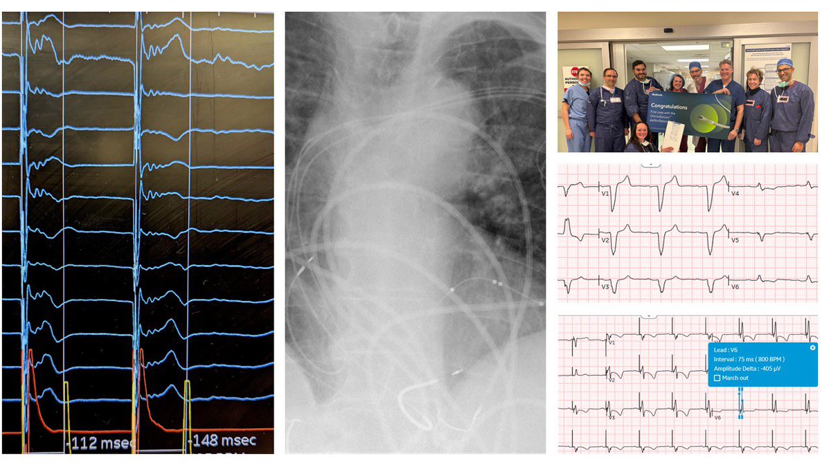 Brett Atwater tweet media