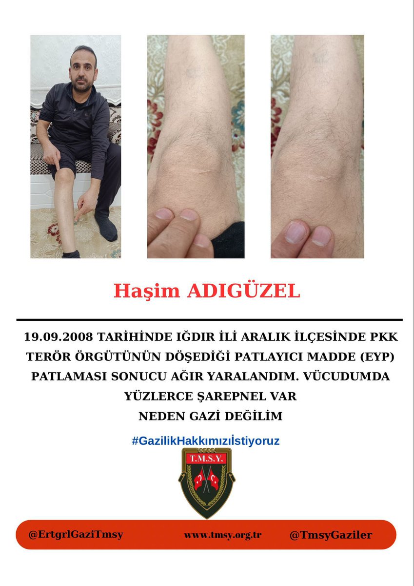 <a href="/MHP_Bilgi/">MHP</a> <a href="/MhpTbmmGrubu/">MHP TBMM Grubu #MHP</a> Yıllardır aynı duayla bekliyoruz: Adalet, vefa ve gazilik onurumuzun teslimi. Sn Bahçeli’den bu konuda güçlü bir adım bekliyoruz.
#GazilikHakkımızıİstiyoruz
<a href="/dbdevletbahceli/">Devlet Bahçeli</a>
<a href="/hulusiakarmedya/">Hulusi AKAR</a> 
<a href="/MahinurOzdemir/">Mahinur Özdemir Göktaş</a> 
<a href="/celebimehmeta/">Mehmet Ali Çelebi</a>
 <a href="/refik_ozen16/">refik ozen</a> 
<a href="/ifarukaksu/">İsmail Faruk Aksu</a> 
<a href="/kocakkonuralp/">Konur Alp Koçak</a> gh