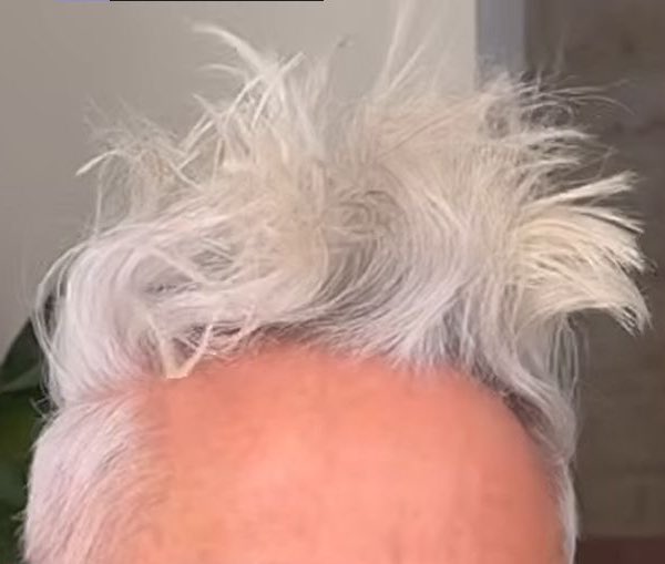 𝓓𝖗. 𝓥𝖔𝕏 𝓞𝖈𝖚𝖑𝖎 ᴹᴰ 👁️‍🗨️ tweet media