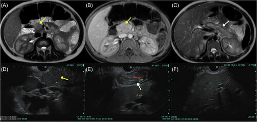 JPGN Reports tweet media
