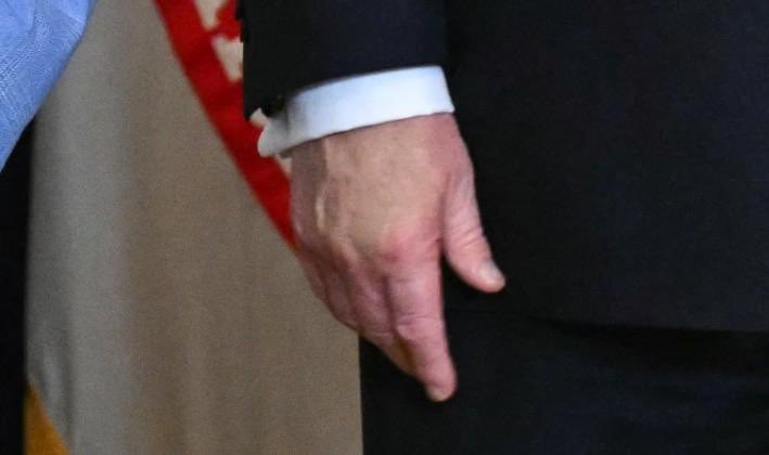 Does he have Greyscale? 👀