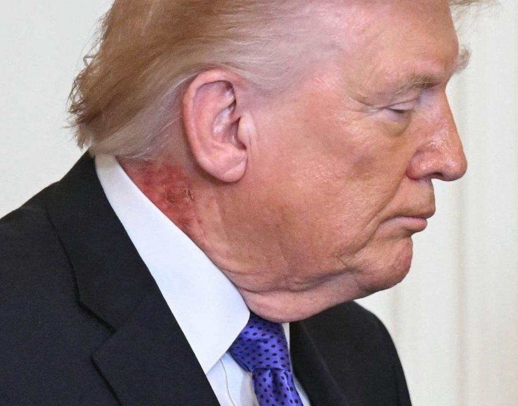 MonitorX tweet media